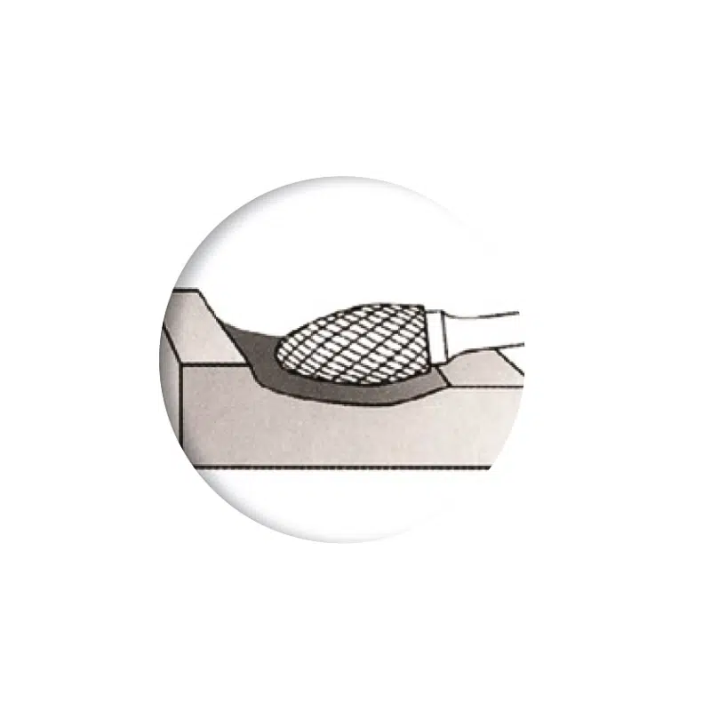 YG8 Rotary Hand File Full Cone 4CUT KRL - Image 3